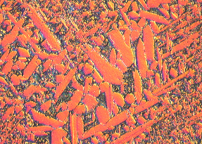 Metallographic micrograph of etched manganese aluminum bronze