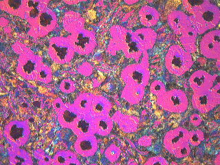 Metallographic micrograph of etched nodular cast iron