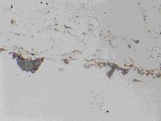 Metallographic micrograph of NiCr plasma spray coating