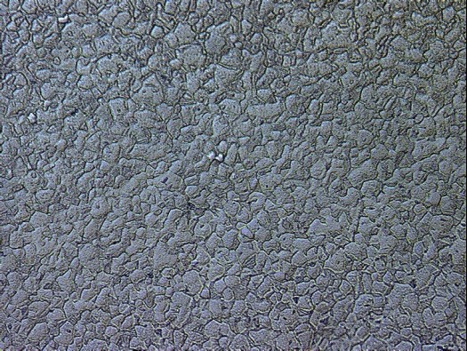 Metallographic micrograph of Titanium Ti6Al4V alloy