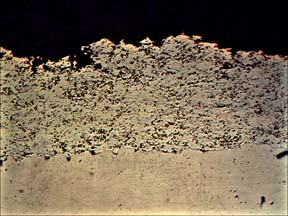 Metallographic micrograph of NiCr plasma spray coating