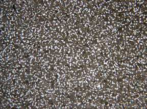Metallographic micrograph of wrought titanium