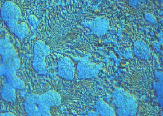 Metallographic micrograph of zinc