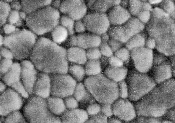 Metallographic micrograph of zicronia ceramic