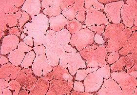 Microstructure of Tough Pitch Copper