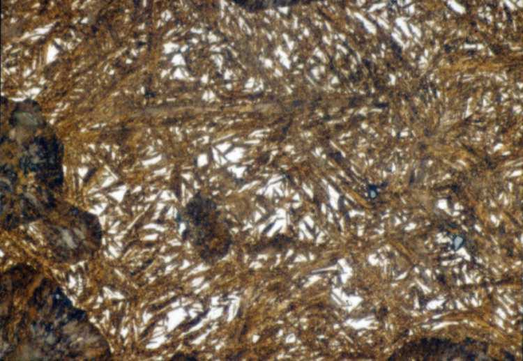 Metallographic micrograph for fast cooled high carbon steel
