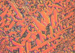 Manganese-Aluminum Bronze Alloy Microstructure, 400X DIC
